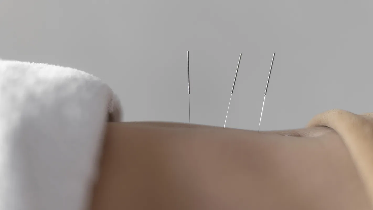 Aiguilles accompagnement